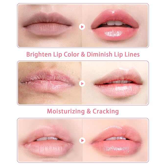 3 Pcs Bee Lip Balm Honey Pot, Honey Strawberry Apple Lip Mask Overnight, Moisturizing Lip Sleeping Mask, Hydrate Repair Prevent Dry Cracked Lip Exfoliator Lip Care (Coconut +Watermelon+Cherry)