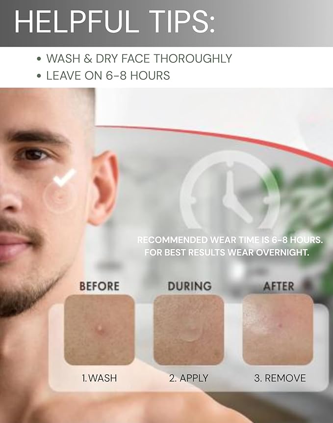 Clear Pimple Patches – 108 Ct Hydrocolloid Acne Patches w/ Salicylic Acid & Tea Tree Oil – Fast-Acting Zit Stickers for Face, Blemish & Spot Treatment – Invisible, Waterproof, Gentle for All Skin
