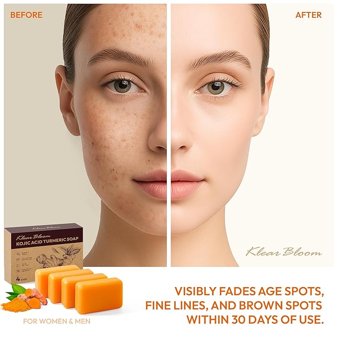 Kojic Acid Soap, Turmeric Soap Bar for Dark Spots Brightening & Moisturizing with Collagen, Vitamin E, Retinol, Hyaluronic Acid, Shea Butter, Paraben & Sulfate-Free 105g x4 Bars With Holder