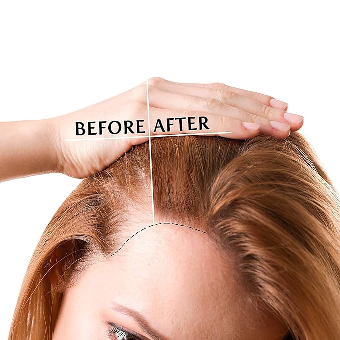 Luv Me Care Biotin Hair Growth Oil Hair Growth Serum for Thicker Longer Fuller Healthier Hair, Prevent Hair Loss & Thinning, All Natural Vitamin Rich Treatment, Women & Men, All Hair Types 1.7 oz