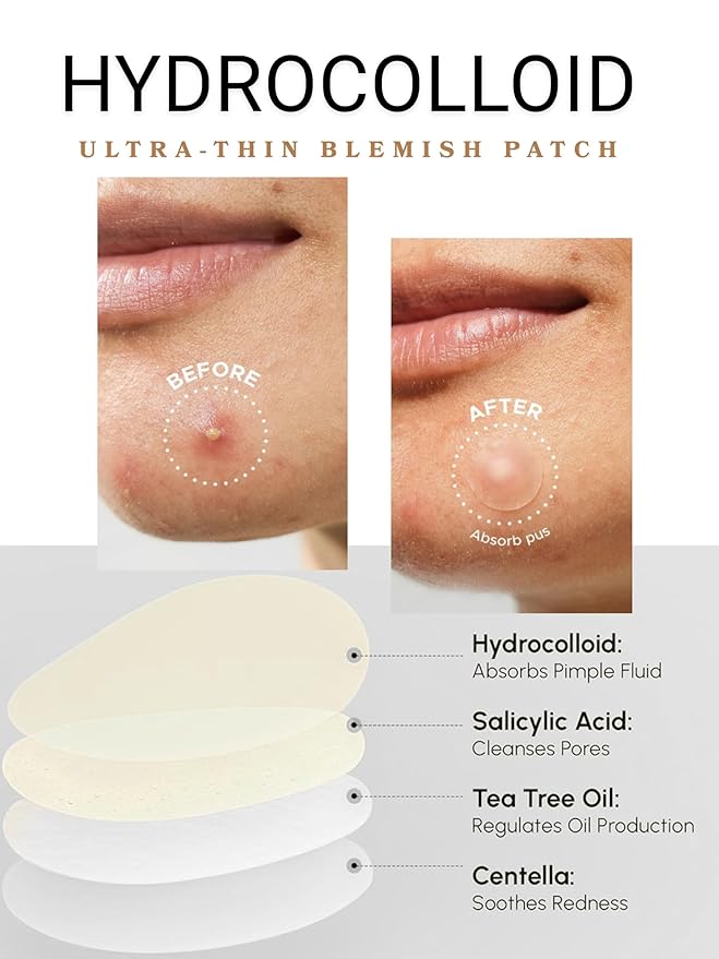 Clear Pimple Patches – 108 Ct Hydrocolloid Acne Patches w/ Salicylic Acid & Tea Tree Oil – Fast-Acting Zit Stickers for Face, Blemish & Spot Treatment – Invisible, Waterproof, Gentle for All Skin