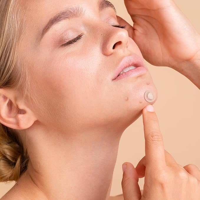 Pimple Patches for Face,Acne Patches for Face,Pimple Patch,Zit Patches,Hydrocolloid Blemish Patches for Covering Zits ,with Salicylic Acid,Tea Tree oil & Calendula oil (108 Counts, Count, 108.0)