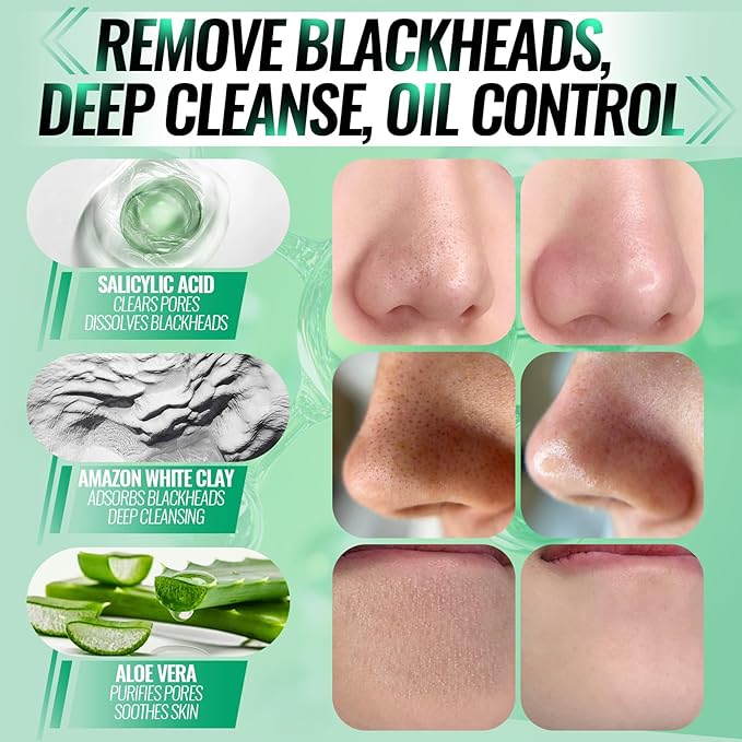 2.0 Nose Pore Strips, Blackhead Remover Mask with Salicylic Acid for Face, Upgraded Deep Cleansing Pore Peel Off Mask with 100 PCS Nose Black Heads Remover Strips (1.7 Ounce)