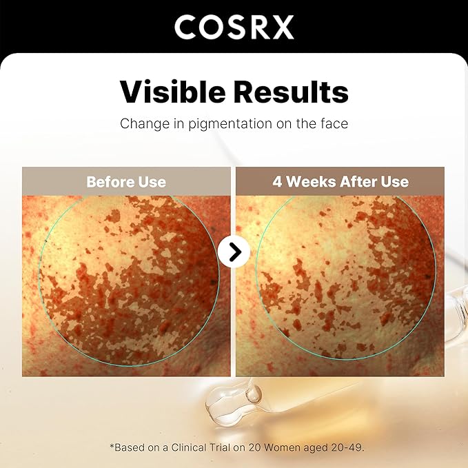 COSRX 2% Alpha Arbutin Discoloration Care Face Serum with Niacinamide, Glutathione & Tranexamic Acid, 1.7 fl oz – Serum for Face, Korean Skin Care, Stocking Stuffers