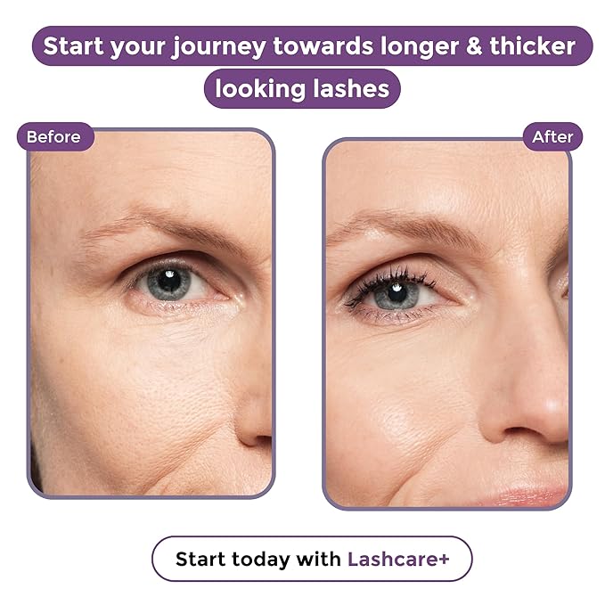 LashCare+ Eyelash Enhancing Serum For Mature Women - Longer, Thicker Lashes in 12 Weeks - For Sensitive Eyes, Natural Growth - Enhancement, Conditioner for Longer-Looking Lashes - 3 Months Supply