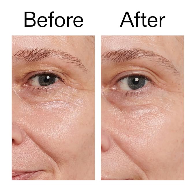 The INKEY List Retinol Eye Cream 0.5 Fl Oz, Reduce Wrinkles and Fine Lines, Night Cream, Vegan Friendly, Suitable For All Skin Types