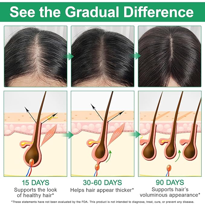 Rosemary Hair Growth Serum Roll On, Hair Thicker Serum with 3% Rosemary, 3% Redensyl & 2% Anagain, Scalp Serum, Reduces Hair Fall & Follicle Strengthener, Thicker, Fuller Hair, All Hair Types (3PCS)