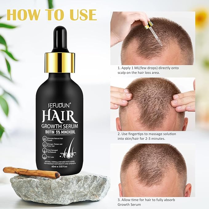 Uocasi 2Pack 5% Minoxidil Hair Growth Serum, Hair Growth for Men and Women, Hair Regrowth Serum For Stronger Thicker Longer Hair Help, Natural Facial Hair Treatment for Grooming Thickening