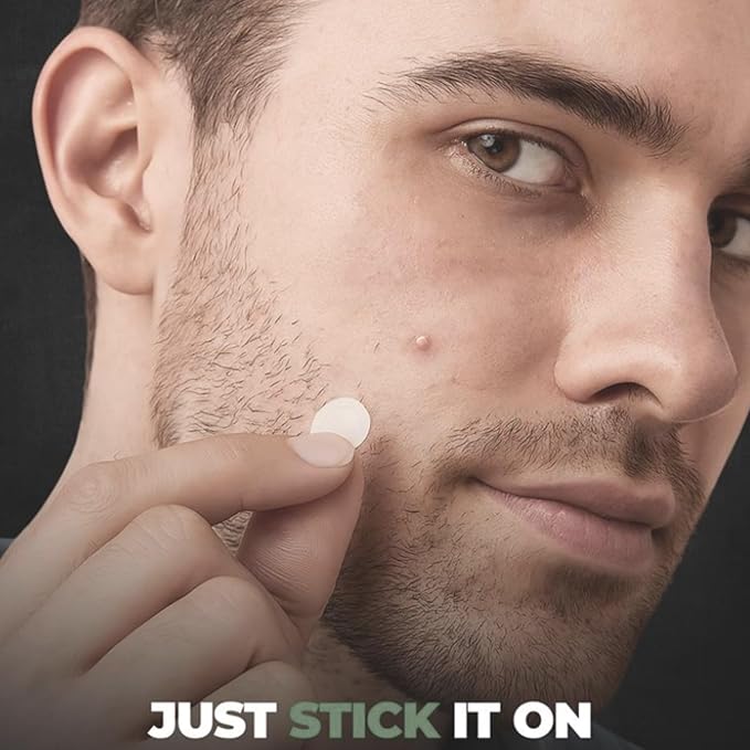 Clear Pimple Patches – 108 Ct Hydrocolloid Acne Patches w/ Salicylic Acid & Tea Tree Oil – Fast-Acting Zit Stickers for Face, Blemish & Spot Treatment – Invisible, Waterproof, Gentle for All Skin