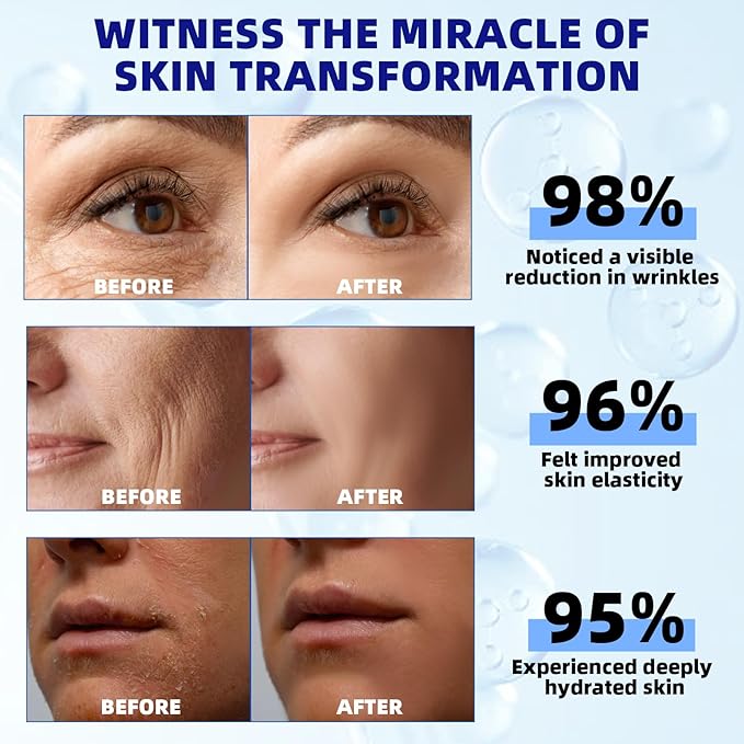 Retinol Serum for Face, 2.5% Retinol Intense Night Serum with Squalane,Vitamin C & E & B3,Hyaluronic Acid for Lines, Wrinkles & Premature Sun Damage to Resurface & Hydrate 30 ml/ 1 Fl oz