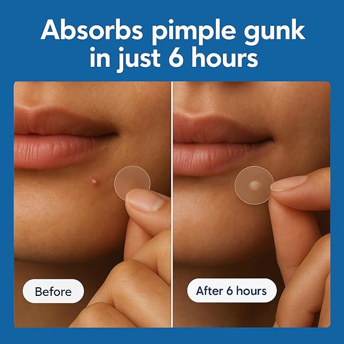 CLEARI Pimple Patches, Invisible 2MM Covers for All Skin Types, Dermatologist Tested,Pore Cleansing, Day & Night, 2 Sizes, 72 Thin Acne Patches for Face and Skin