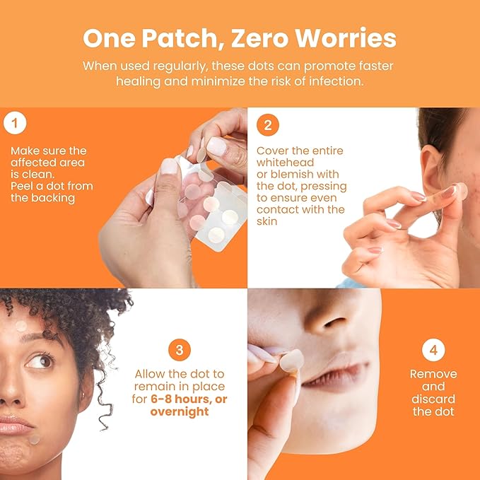 Patchology Not A Spot Hydrocolloid Pimple Patches – 48 Clear Acne Stickers for Face and Body – Skin-Friendly Spot Treatment for Whiteheads, Blemishes, and Breakouts – Invisible and Travel-Friendly