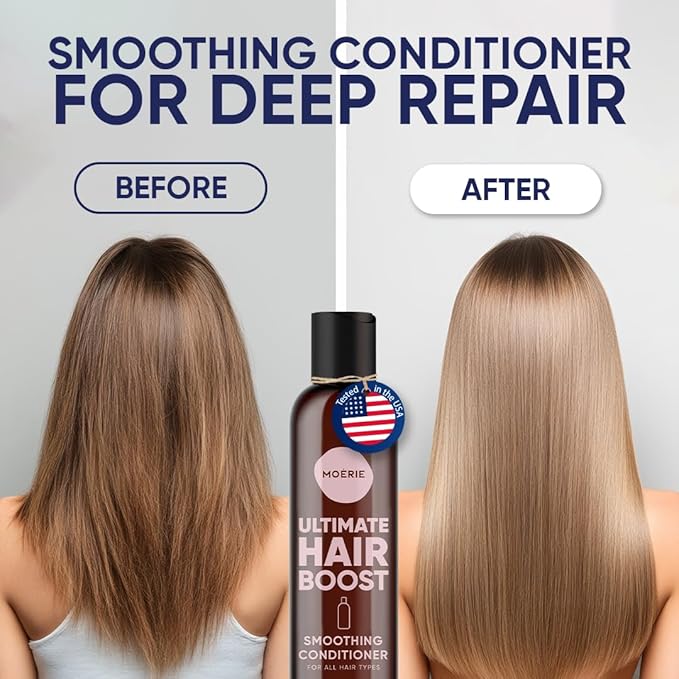 Moerie Ultimate Hair Growth Conditioner – For Longer, Thicker, Fuller Hair - Vegan Friendly Volumizing Hair Products – Paraben & Silicone Free – All Hair Types – Reverse Hair Loss – Triple Set
