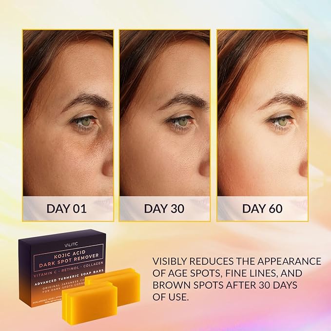 Valitic Kojic Acid Dark Spot Remover Soap Bar with Vitamin C, Retinol, Collagen, Turmeric - Original Japanese Complex - Hyaluronic Acid, Vitamin E, Shea Butter, Castile Oil ( 4 Pack ) With Soap Holder