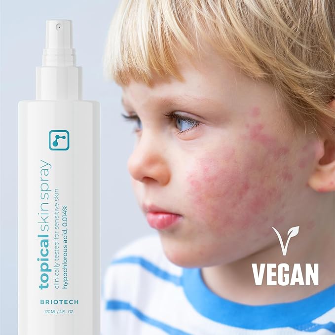 BRIOTECH Topical Skin Spray, Hypochlorous Acid Spray for Sensitive Skin, HOCl Facial Mist, Full Body Support Against Irritation, Calm Redness, Soothe Foot & Scalp, 8 oz (1 Pack)