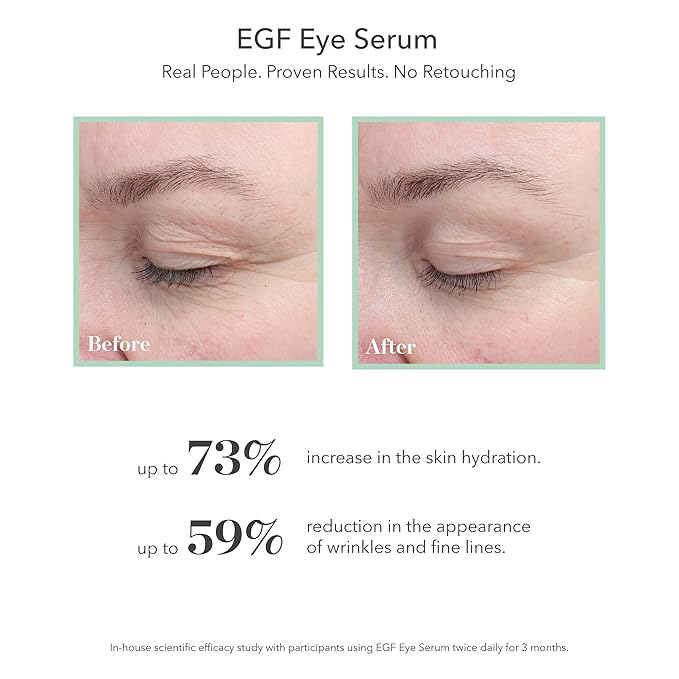 BIOEFFECT EGF Eye Serum Refill Set with Cooling Rollerball (6 ml) and One Refill Cartridge (6ml), Anti-Aging Corrective Gel with Hyaluronic Acid for Puffy Bags, Wrinkles, Fine Lines and Crows Feet
