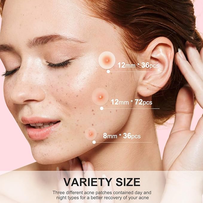 AVJONE Pimple Patches for Face(144 Patches), Hydrocolloid Acne Patches with Tea Tree Oil, pimple stickers for Breakouts, Absorbs Zit, Invisible Spot Cover and Blemish