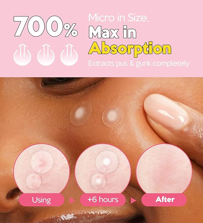 Troubless Invisible Plus Spot Patch The Micro Signature - Thin Hydrocolloid for Seamless Coverage - Comfortable & Easy-Wear Patches for Face (0.8cm & 1cm, 123 ea)