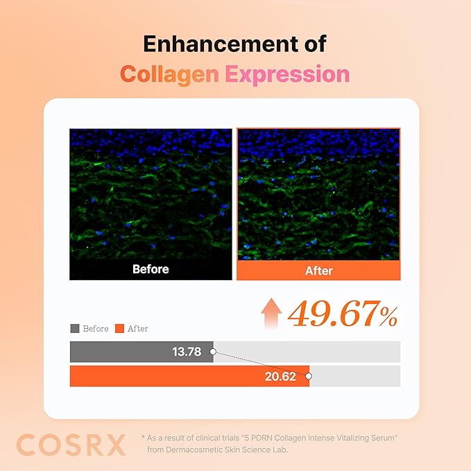 COSRX 5 PDRN Collagen Intense Vitalizing Serum - Korean Serum for Skin Firming & Glowing with Salmon DNA, Centella, Lactobacillus PDRN & Collagen, Korean Skin Care, Stocking Stuffers (3.38 fl.oz.)