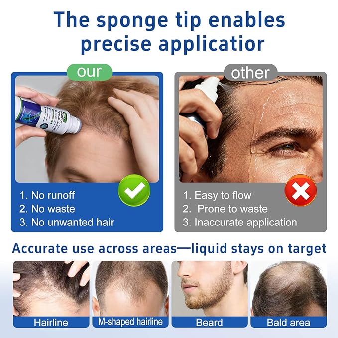 5% minoxidil hair growth Serum for women & men with biotin - with sponge applicator for thinning hair & receding hairline 8-month supply-6pcs Packs 2.71 fl oz per bottle