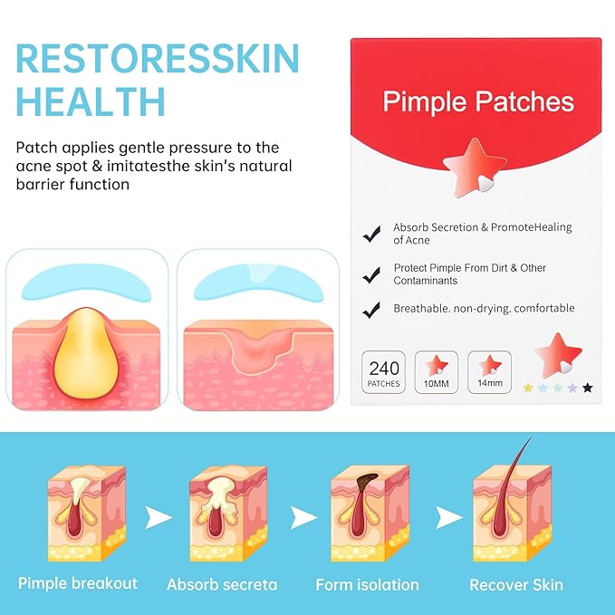 Pimple Patches for Face, Cute Star Zit Covers, Stars Hydrocolloid, For Sensitive Skin, with Tea Tree, Salicylic Acid & Cica Oil (10&12&14mm) 240 Count
