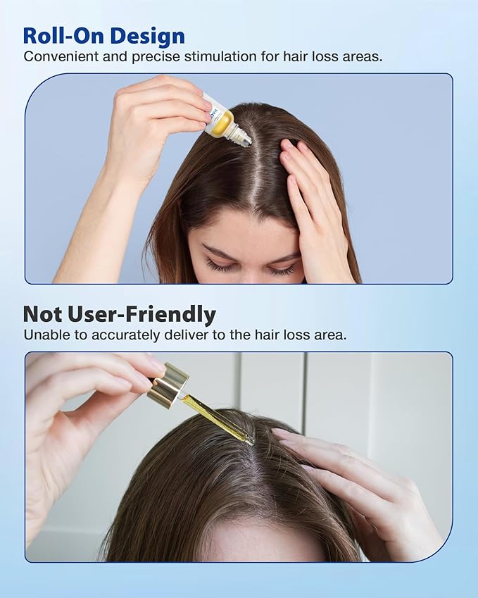 Hair Growth Serum Roll On 30ml – 3% Rosemary, 3% Redensyl，2% Anagain, Niacinamide & Tocopherol | Reduces Hair Loss at the Root for Men & Women | No-Rinse, Non-Greasy, Fast-Absorbing