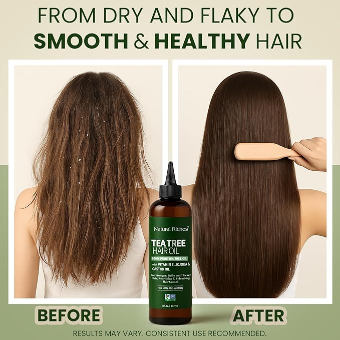 Natural Riches Tea Tree Oil for Hair - Blended with Vitamin E and Castor Oil for Hair Growth - Tea Tree Scalp Treatment for Dry Scalp - Lightweight Scalp Oil for Healthy, Strong Hair - 8 fl oz