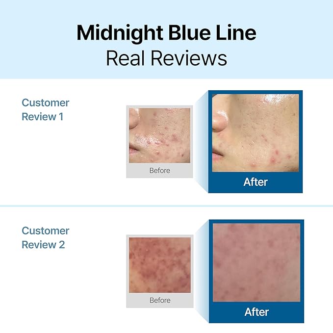 DearKlairs Midnight Blue Calming Cream – Soothing Face Moisturizer for Oily & Sensitive Skin, Redness Relief & Hydrating, Lightweight Texture, 2.11 Oz