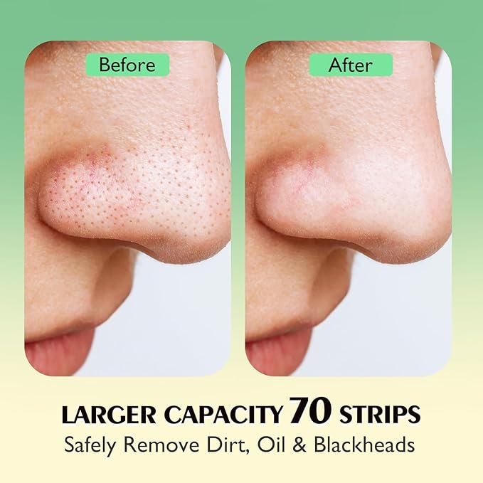 AUSLKA Blackhead Pore Strips,(70 Counts) Blackhead Remover-Deep Cleansing Nose Strips With Instant Pore Unclogging, Nose Plant Strips for Blackheads