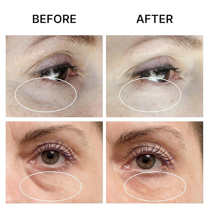 SEAMANTIKA PUFFINESS AWAY Eye Cream 0.8 fl.oz - Instant Eye Bag Remover Puffiness with Eyeliss; Vitamin C, Under Eye Puffiness Reducer Instant Results, Temporary Reduction of Wrinkles & Dark Circles