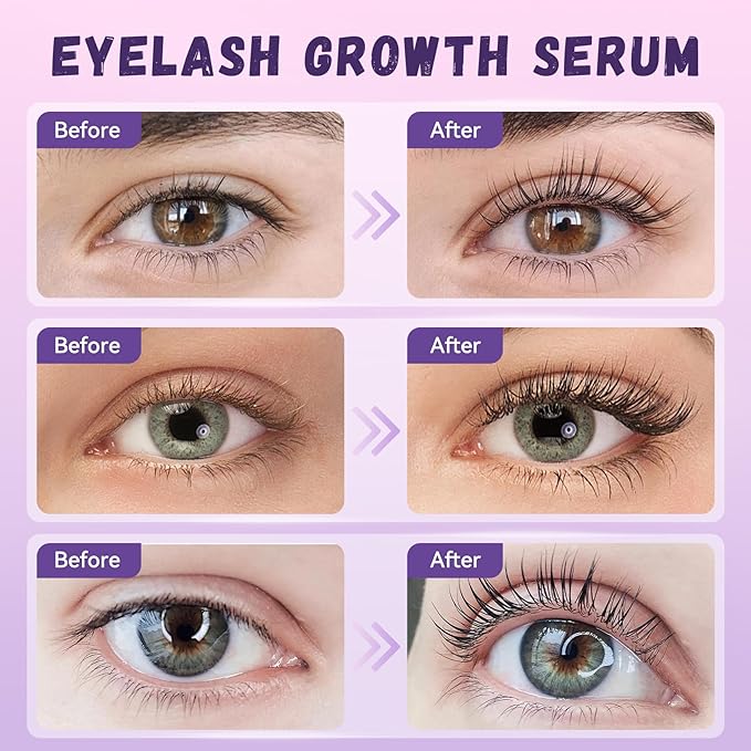 Lash Serum Natural & Vegan Eyelash Growth Serum for Longer, Thicker, Fuller Lashes Nourishing & Conditioning Formula Safe for Sensitive Eyes - 5ml
