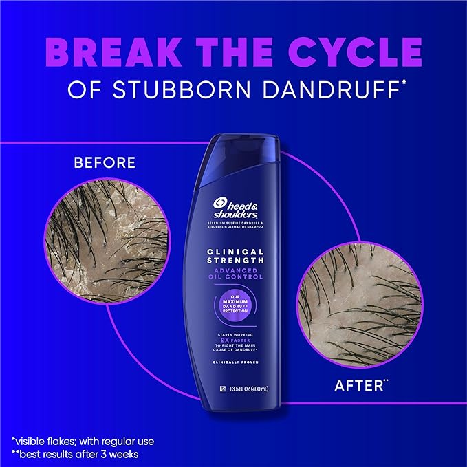 Head & Shoulders Dandruff Shampoo, Clinical Strength Advanced Oil Control, Our Maximum Anti-Dandruff Prescription-Strength Formula, Flake Protection, Seborrheic Dermatitis Relief, Citrus, 13.5 Fl Oz