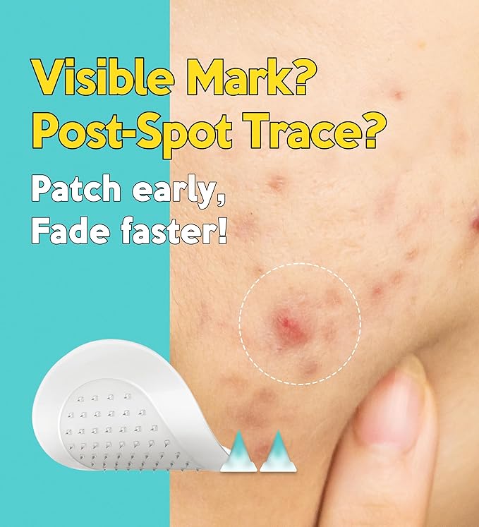 Troubless Micro Patch Plus Vitamin C - Zit Hydrocolloid Patch for Stubborn Marks with 10% Vitamin C - Micro-Dissolving Pyramids for High-Absorption, Seamless Adhesion & Easy-Wear (9 EA)