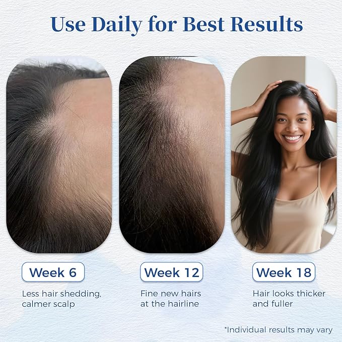 Hair Growth Serum Roll On 25ml with Saw Palmetto, Rosemary & Pea Extract，Helps Support Thicker, Fuller Hair Appearance，Clean, Non-Greasy Hair Loss Support for Men & Women Pack of 1
