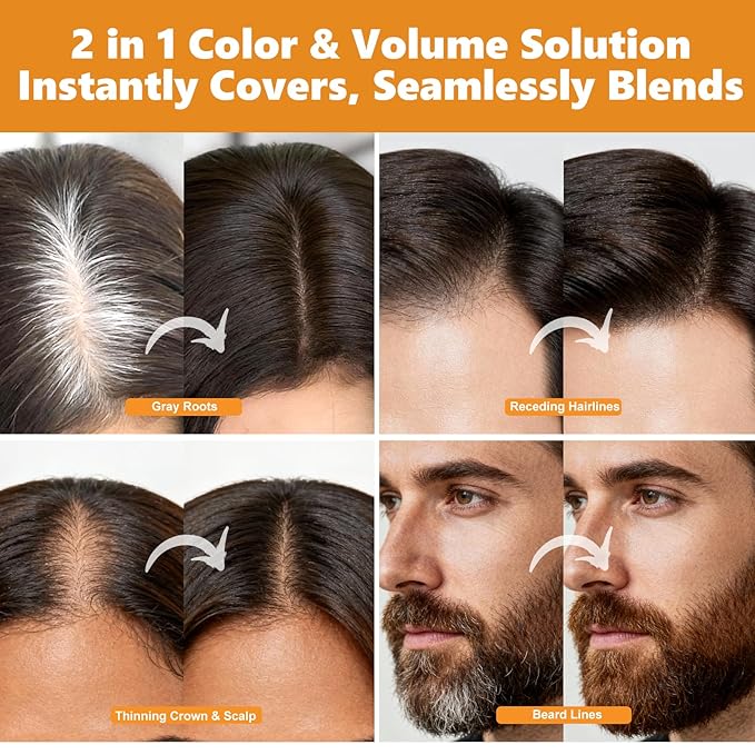 Root Touch Up Hair Color Spray – 4oz, Sweat-Resistant & Natural, Instant Gray Hair Cover Up, Temporary Root Concealer Spray for Roots, Hairline & Scalp– Dark Brown – Women & Men