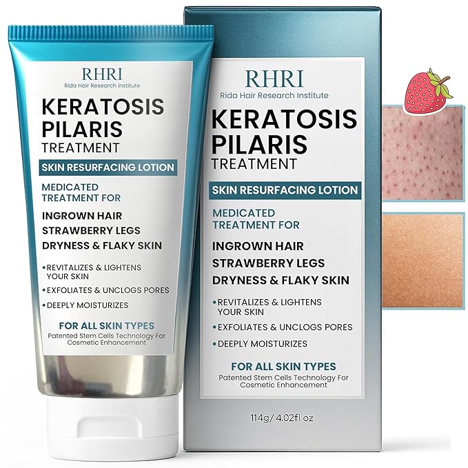 Keratosis Pilaris Treatment | Keratosis Pilaris Lotion | KP Lotion | Gentle Exfoliation For Strawberry Legs, KP & Ingrown Hairs | Smooth & Hydrating Body Lotion For Redness, Dry, Rough And Flaky Skin