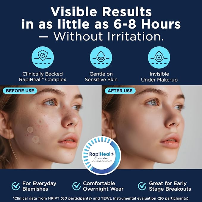 Pimple Patches for Face - 134 Count Hydrocolloid Acne Patches - Zit, Blemish, Cystic Acne Dots & Dark Spot Treatment - Invisible Clear Pimple Patch Stickers for Forehead, Chin, Nose, 3 Sizes (S, M, L)