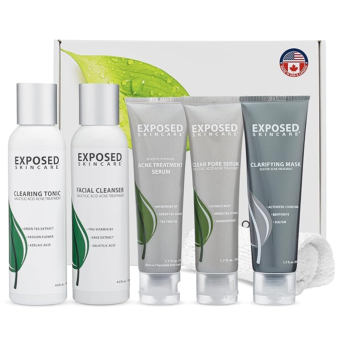 Exposed Skin Care, Acne Treatment Kit with 2.5% Salicylic Acid and 3.5% Benzoyl Peroxide to Clear Up Teen, Adult, Hormonal and Cystic Acne – Natural, Non-toxic and Cruelty Free