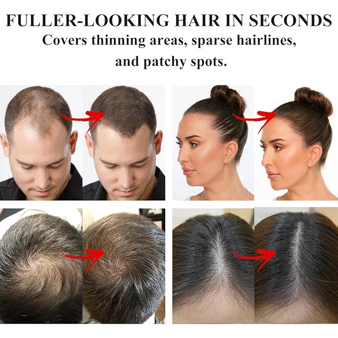 VOLLUCK Root Touch up Powder, Instant Hairline Powder for Thinning Areas and Gray Hair Coverage, Natural and Non-greasy Root Cover up for Women and Men (Light Blonde, 0.14 Ounce)