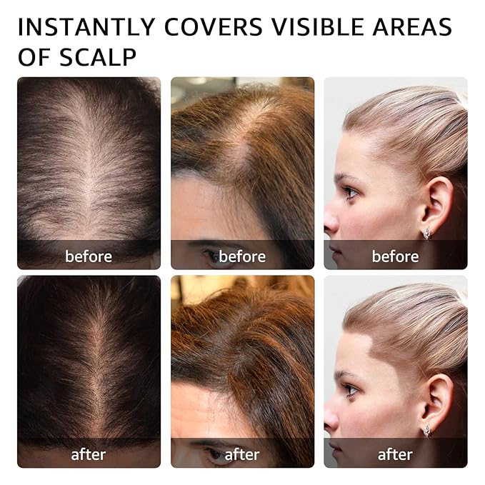 Instantly Hairline powder, Root touch up hair color for gray coverage, hair powder for women men bald spot loss and thin concealing（Dark Brown)