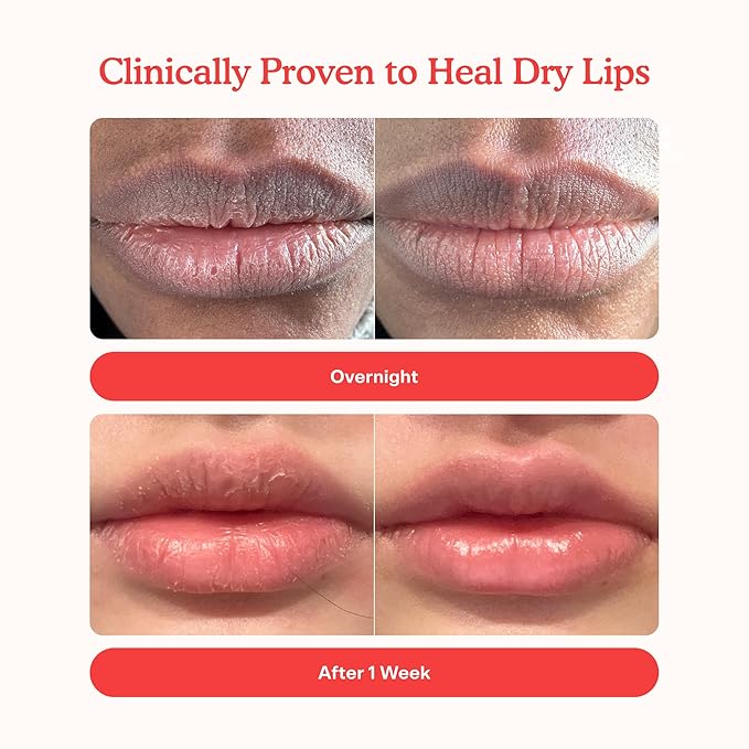Tower 28 LipSoftie Hydrating Tinted Lip Treatment Balm, Moisturizing Lip Mask for Chapped Lips - Watermelon Kiwi Flavor, Sheer Baby Pink Gloss