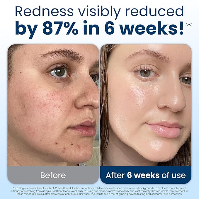 Clean Skin Club Clean Towels XL®, 100% USDA Biobased Face Towel, Disposable Face Towelette, Eczema Association Accepted, Makeup Remover Dry Wipes, Ultra Soft, 50 ct per pack, 2 Packs, 100 Ct Total