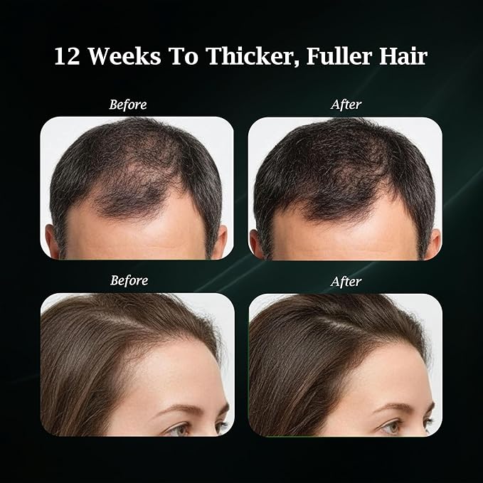 Unnamed Hair Growth Peptide Serum for Thinning Hair | Copper Peptide Hair Growth Serum (GHK‑Cu), Multi-Peptide + Caffeine | Boosts Hair Density, Reduces Shedding | Scalp Serum for Women & Men