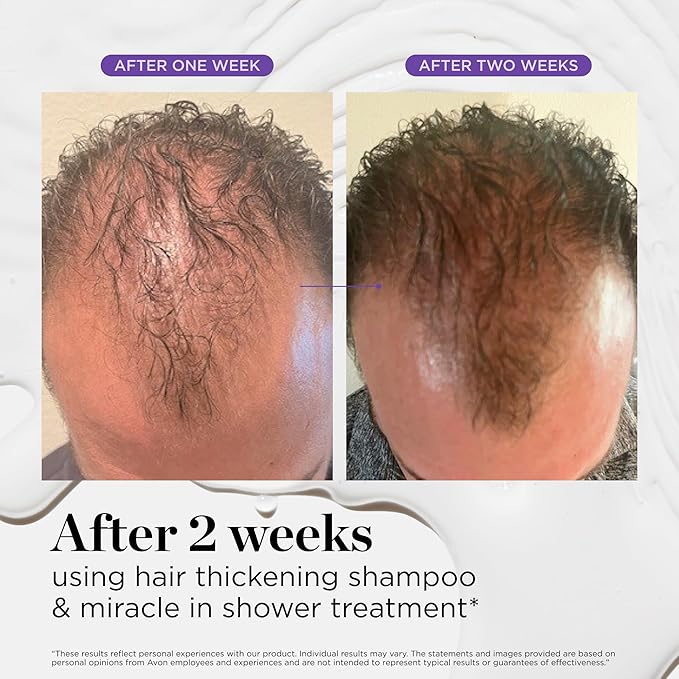 Dr. Groot Miracle in Shower Moisturizing Treatment for Hair Loss, Korean Hair Care Rinse, Rosemary Oil for Smooth, Healthier-Looking Hair in 5 Seconds, Scalp Revitalizing Solution, 250 ML