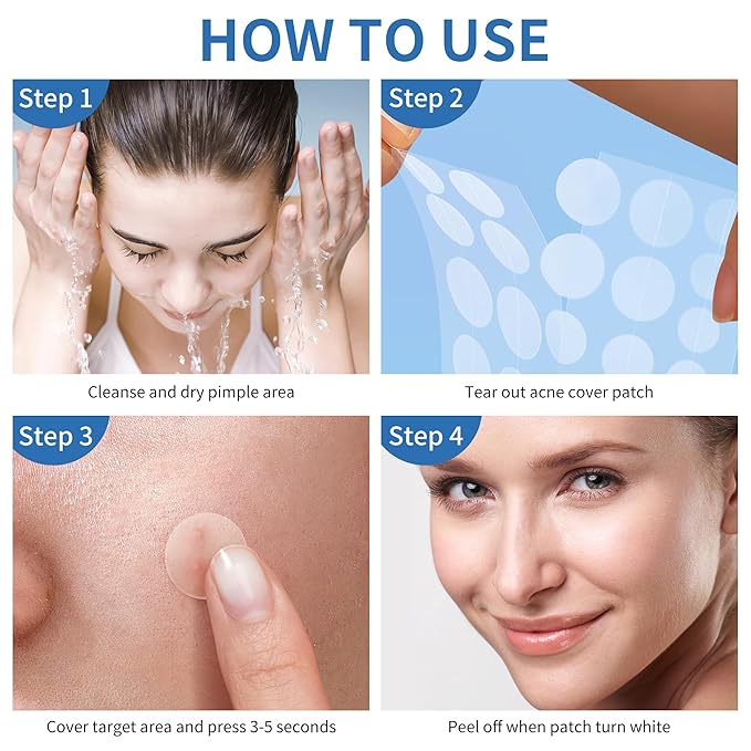 Pimple Patches for Face, 4 Size 300 Counts Acne Patches, Hydrocolloid Patches for Covering Zits and Blemishes, Spot Stickers with Salicylic Acid, Tea Tree Oil & Calendula Oil