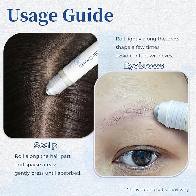 Hair Growth Serum Roll On 0.84Oz/25ml with Saw Palmetto, Rosemary & Pea Extract，Helps Support Thicker, Fuller Hair Appearance, Non-Greasy Hair Loss Support for Men & Women (1pcs)