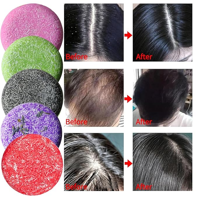 8 Pack Shampoo Bar Gift Set,Natural Soap, Solid Dry Damaged Hair With Plant Essence Oil Helps Stop Loss and Promotes Healthy Growth, Travel Size Bulk Set