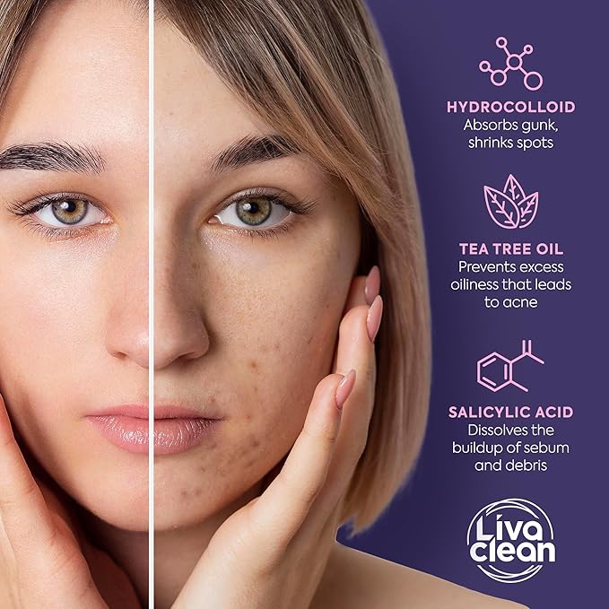 Livaclean Star Pimple Patches for Face w/ Hydrocolloid, Tea Tree oil & Salicylic Acid - Zit Stickers, Hydrocolloid Acne Patches for Face - Cute Pimple Patch, Acne Stickers