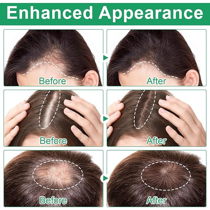 Hair Growth Serum Roll-On with 3% Rosemary Oil, Redensyl & AnaGain - Scalp Revitalizing Treatment for Fuller-Looking Hair - Non-Greasy, 0.67 fl oz
