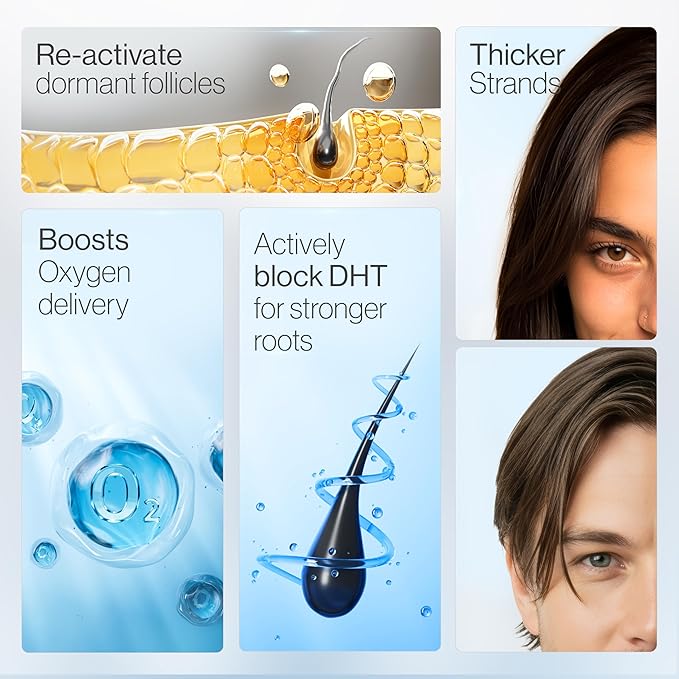 Be Bodywise Rosemary Hair Growth Serum Roll On 25 ml – 3% Rosemary, 3% Redensyl & 2% Anagain | DHT-Blocking Scalp Serum Boosts Oxygen Flow, Reduces Hair Fall | Paraben/Sulfate-Free | Women & Men